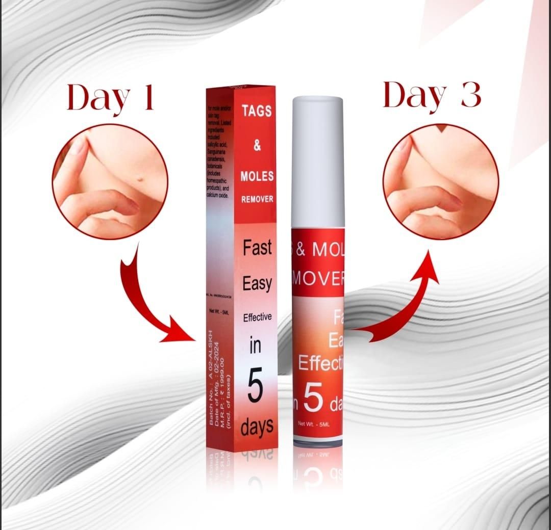 Tags & Moles Remover ( 🔥  Buy 1 Get 1 Free 🔥 )