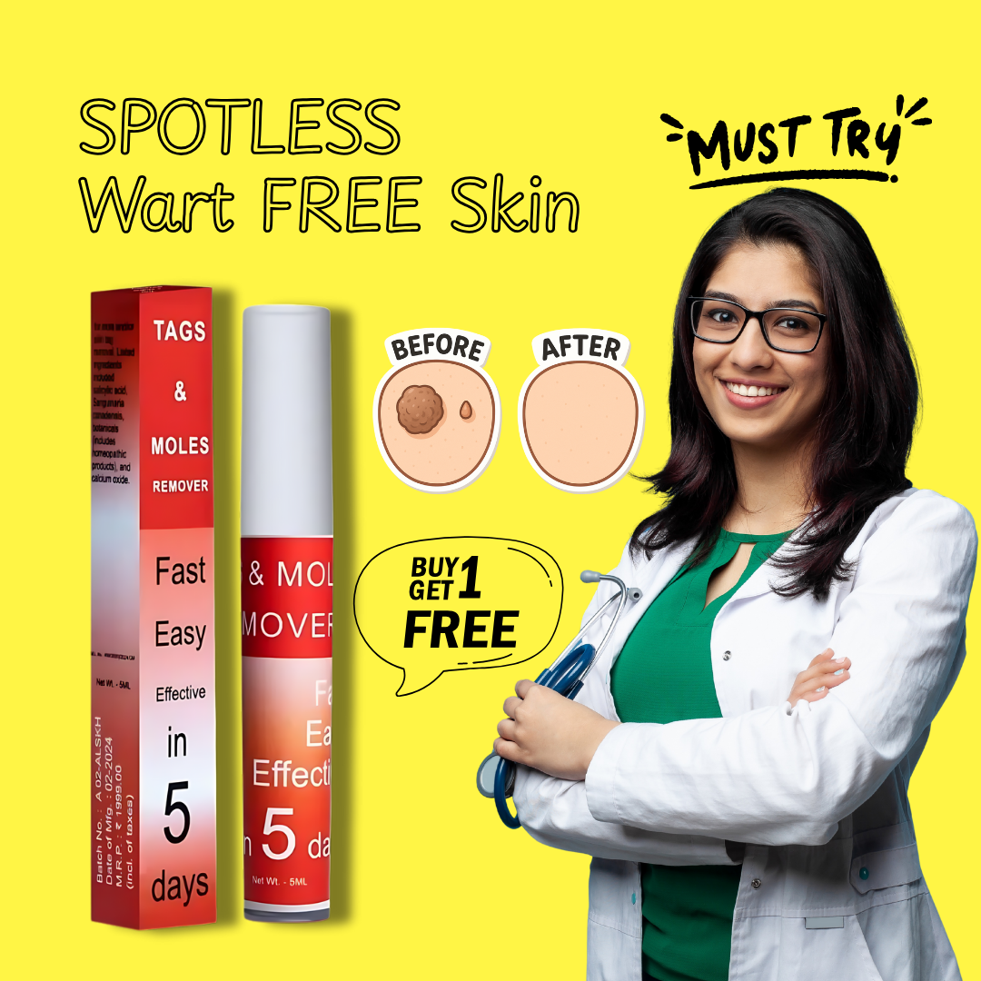 Tags & Moles Remover ( 🔥  Buy 1 Get 1 Free 🔥 )
